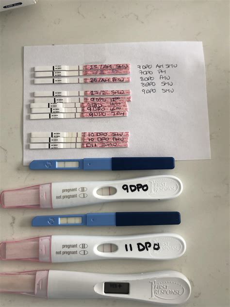 Cm 5dpo. Joining in here to keep track of symptoms. I'm after MC, and since the week after the Mc until today I've been having symptoms. So here goes! 1dpo- Nausea, sharp pelvic pain/pubic bone, fatigue, elevated temp in evening 2dpo- Nausea, sharp pelvic pain/pubic bone, migraine, elevated temp in evening 3dpo- Cramps, Pelvic pain, creamy/watery CM, tired, headache 4dpo- Sharp pains on both sides ... 