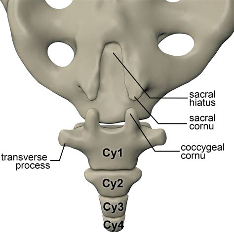 Introduction. Coccygodynia or Coccydynia is pain in the area of coccyx which can occur due to acute trauma (fall, dislocation, child birth, sprained ligament), chronic trauma (osteoarthritis), metastasis (rectal or colon carcinoma) or can be a referred pain (vaginismus, chordoma).[1,2] True incidence of coccygodynia is unknown and the male-to-female ratio is 1:5.. 