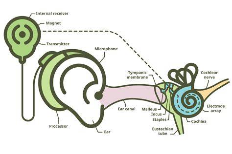 Cochlear