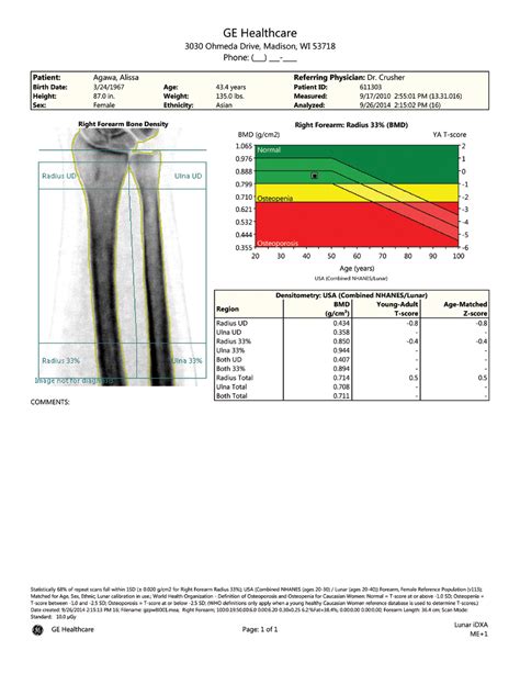 Coding for bone-density DEXA of hips and forearm