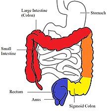 Colitis - Wikipedia