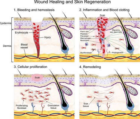 Collagen matrix-bound clotting factors (CMBCF) promote healing ...