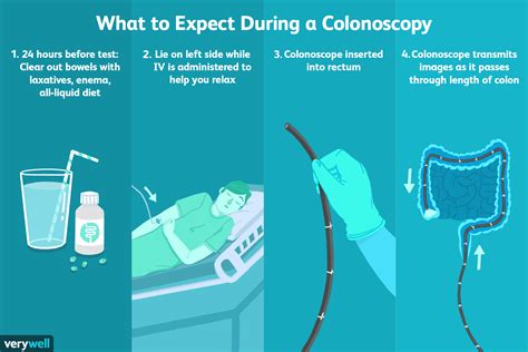 Colonoscopy What to Expect IU Health