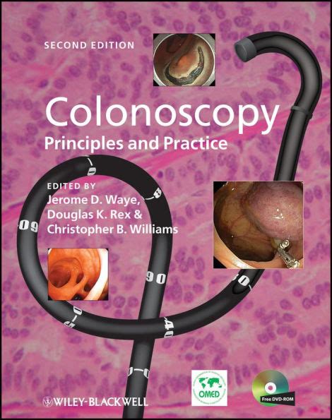 Read Online Colonoscopy Principles And Practice By Jerome D Waye