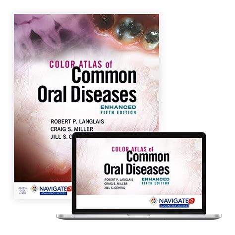 Read Color Atlas Of Common Oral Diseases By Robert P Langlais