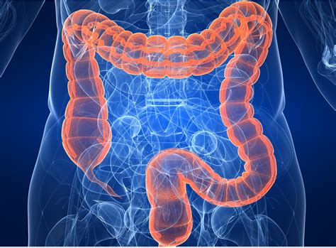 Colorectal Cancer