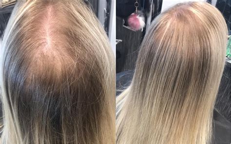 Coloring Hair After Bleaching
