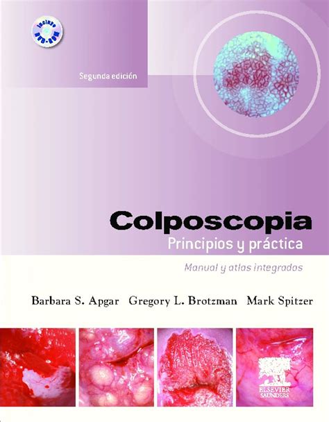 Colposcopia principios y pr ctica dvd rom manual y atlas. - 1993 toyota land cruiser owners manual.