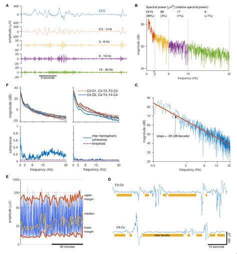 Combining SPECT and Quantitative EEG Analysis for the …