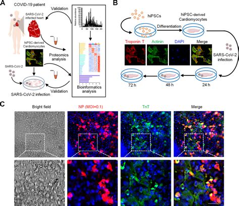 Combining patient proteomics and in vitro cardiomyocyte …