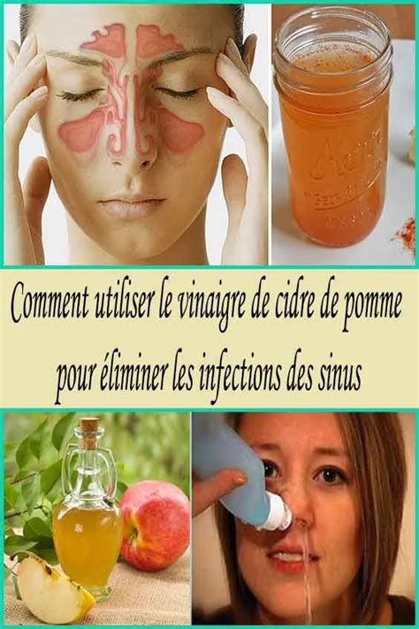 Comment éliminer naturellement une infection des sinus