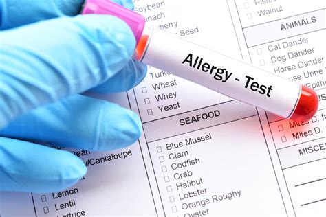Common Allergies Tested for in an Allergy Test TLC Medical