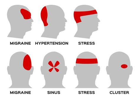 CommonCausesofSharpPainintheBackoftheHead