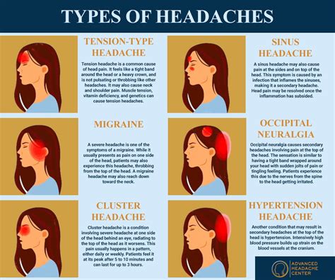 Effective Strategies for Managing Chronic Head Pain