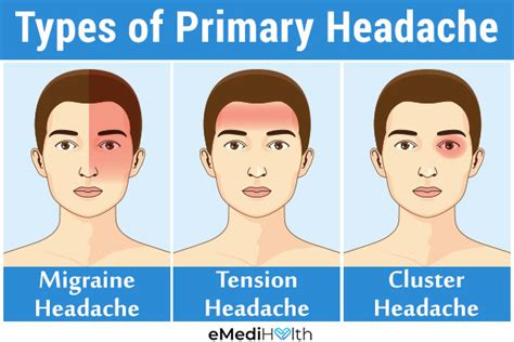 CommonTypesofPrimaryHeadaches