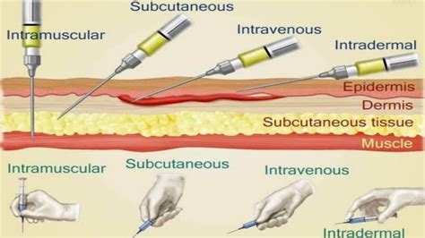 Comparing the effects of intravenous and subcutaneous ... - Nature