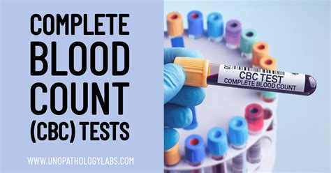 Complete Blood Count (CBC) Test Costs & Normal Ranges Chart.