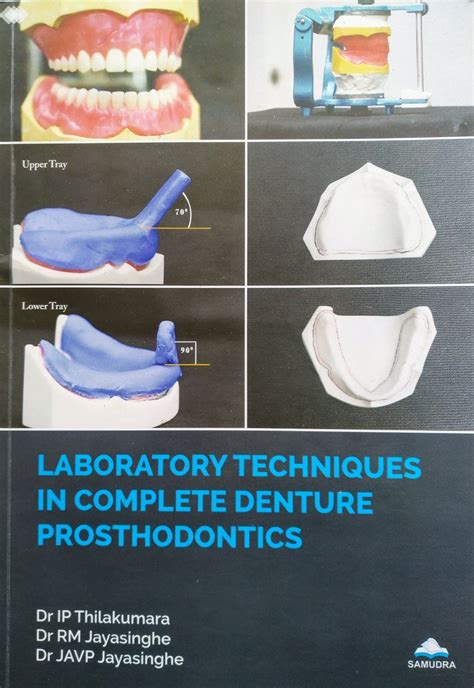 Complete denture prosthodontics clinic manual department of prosthodontics virginia commonwealth university. - Ase guía de estudio de servicio pesado.