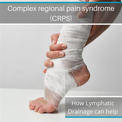 Complex Regional Pain Syndrome (CRPS) - Caring Medical