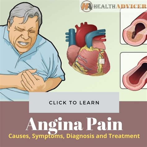 Complications of angina - zana.com