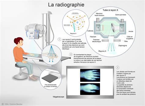 Composante RAdioLogique de l