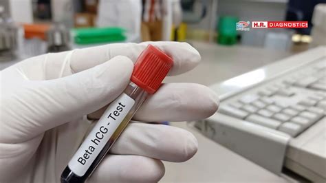 Comprehensive Guide to Beta HCG Test HR Diagnostic