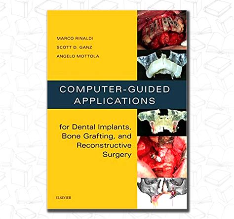 Computer guided applications for dental implants bone grafting and reconstructive surgery adapted translation 1e. - Meine patienten, die kumpels und ich.
