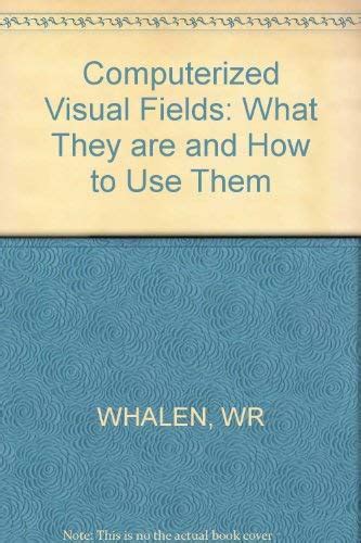 Full Download Computerized Visual Fields What They Are And How To Use Them By William R Whalen