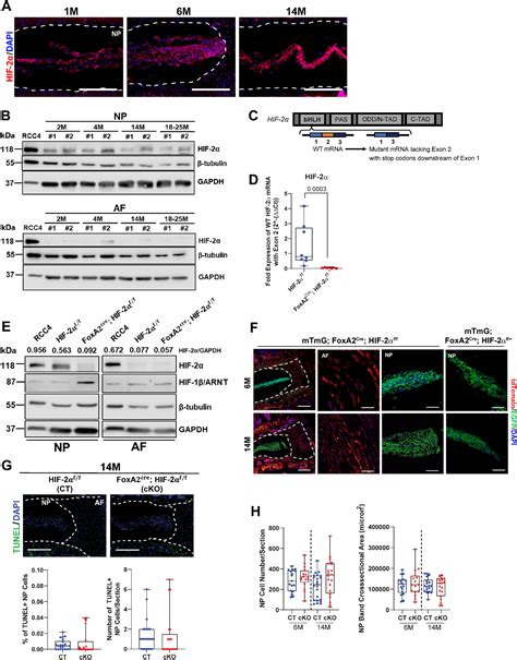 Conditional Deletion of HIF‐2α in Mouse Nucleus Pulposus …