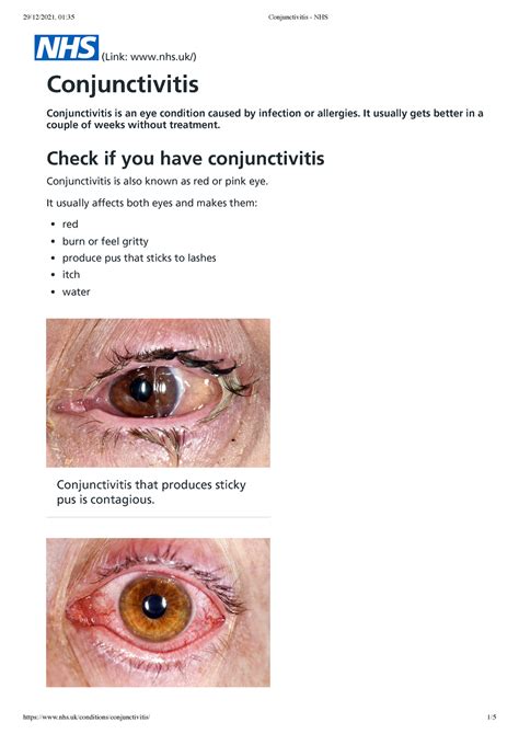 Conjunctivitis NHS inform