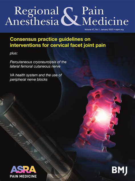 Consensus practice guidelines on interventions for cervical spine