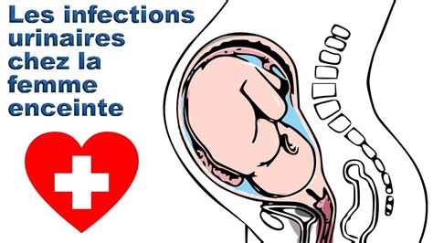 Considérations pratiques sur l'éclampsie des femmes enceintes et des femmes en couche. - Nclex study guide 2015notes 22 history alive teachers guide.