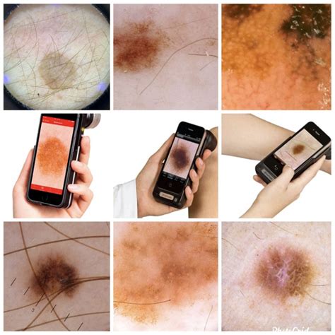 Contact < Mole Mapping & Dermatoscopy Software - MoleExpert