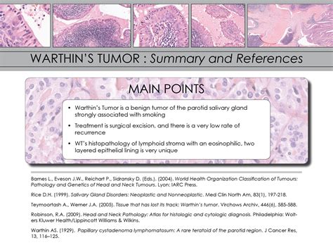 Contemporary diagnosis and management of Warthin