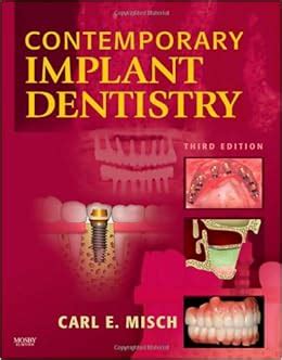 Read Contemporary Implant Dentistry By Carl E Misch