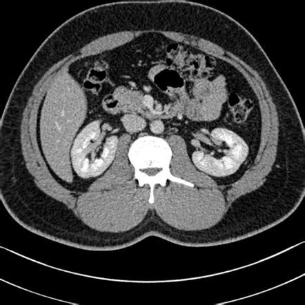 Contrast phases Radiology Reference Article