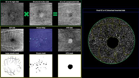 Contrast sensitivity function in patients with macular disease and …