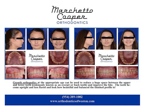 Cooper orthodontics. Cooper Orthodontics is a South Florida orthodontist that serves the people of Margate … 
