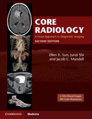 Core radiology a visual approach to diagnostic imaging. - Fou-ressurser i høyere utdanning: utviklingen 1981-1991.