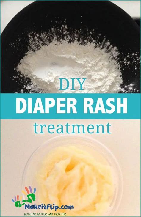 Corn Starch on Diaper Rash? BabyCenter