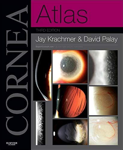 Read Online Cornea Atlas Expert Consult  Online And Print By Jay H Krachmer