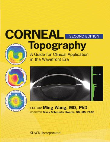 Corneal topography a guide for clinical application in wavefront era 2nd edition. - Schumacher speed charger 15 amp manual.