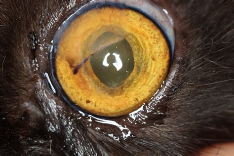 Corneoconjunctival transposition with and without ACell