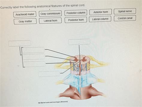 Anatomy and Physiology questions and answers. Correctly label the following anatomical features of the spinal cord. Fat in epidural space \begin {tabular} {c} Posterior root \\ ganglion \\ \hline \end {tabular} Pia mater Meninges Spinal cord Subdural space Subarachnoid space Denticulate ligaments Arachnoid mater Dura mater (dural sheath) . 