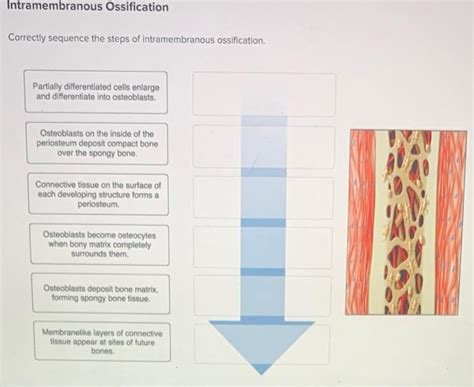 Correctly sequence the steps of intramembranous ossification. Things To Know About Correctly sequence the steps of intramembranous ossification. 