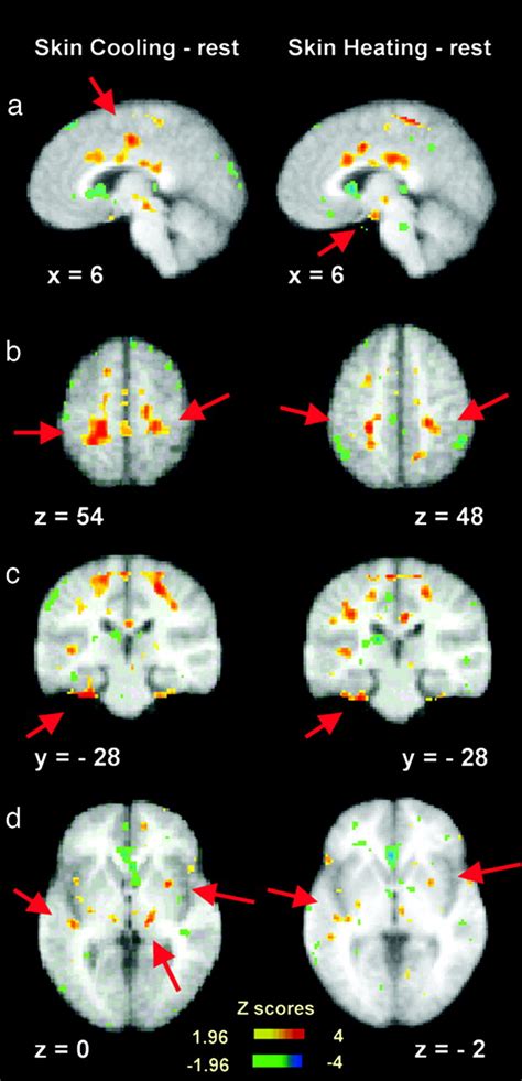 Cortical, thalamic, and hypothalamic responses to cooling and ... - PNAS