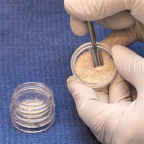 Cortical cancellous allograft cpt code. .  <a href=http://www.repper.ro/sites/def...