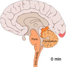 Cortical spreading depression - Wikipedia