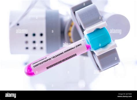 Corticotropin Releasing Hormone CRH. Test Tube with Artificial Hormone