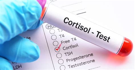 Cortisol (Blood)